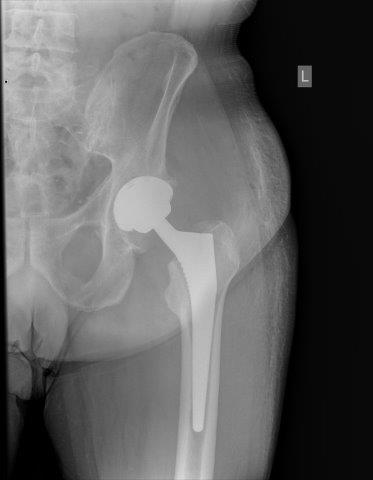 Dokter Dujardin Jan orthopedie heup en knie specialist traumatologie operatie nieuwe knie heup prothese meniscus kruisband sportgeneeskunde izegem hechting kraakbeen operatie chirurg heelkunde arthrose arthritis pijn petré defoort vandendriessche knieprothese heupprothese topdokter arts kunstknie topdokters beste kunstheup topchirurg